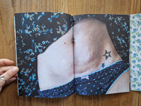 Undo Motherhood