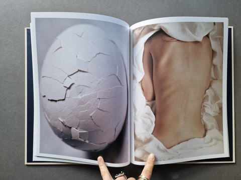 An open book showing two photographic pages: one of a cracked pale egg and one of a person's bare back resting on white fabric.
