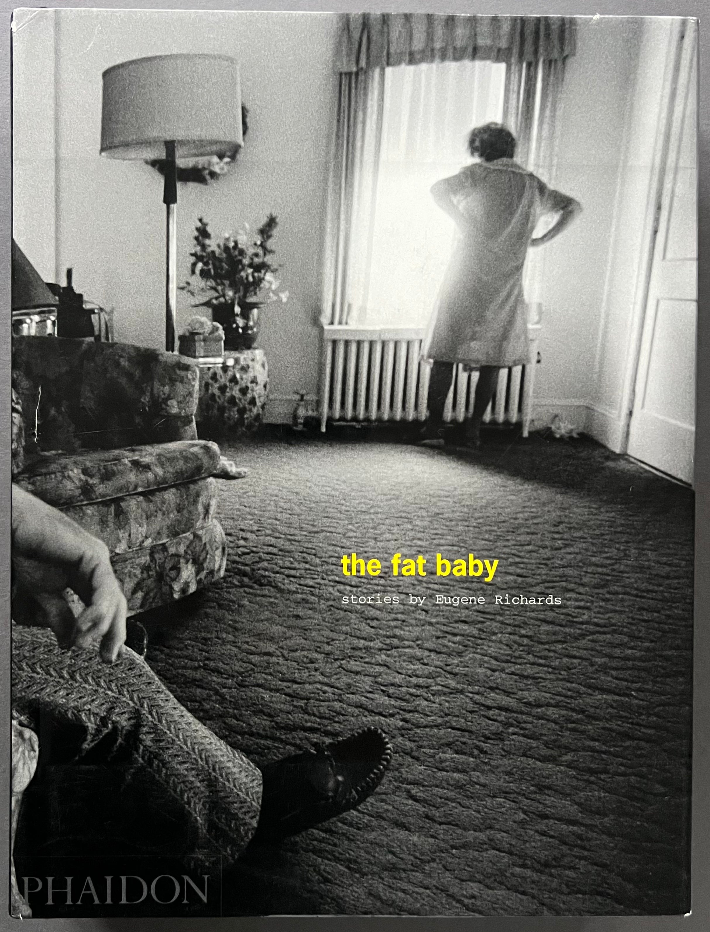 The_Fat_Baby_Eugene_Richards_1 The_Fat_Baby_Eugene_Richards_1