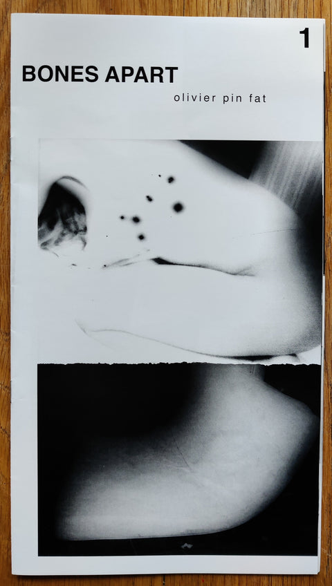 Bones Apart