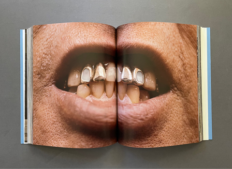 An open book or magazine spread photographed from above on a dark gray background, featuring a close-up photographic print of a person's mouth and teeth with gold-colored dental crowns.
