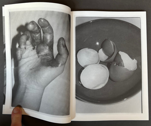 She Could See Herself in the Darkness