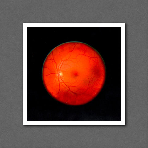 Retinal Self Portrait, Left Eye