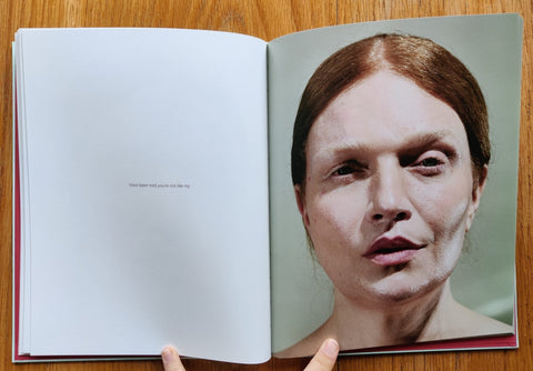 Glitter in My Wounds - Setanta Books