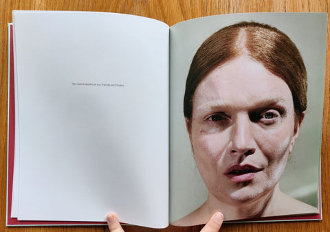 Glitter in My Wounds - Setanta Books